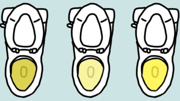 La couleur de votre urine en dit long sur votre santé Voici ce quil