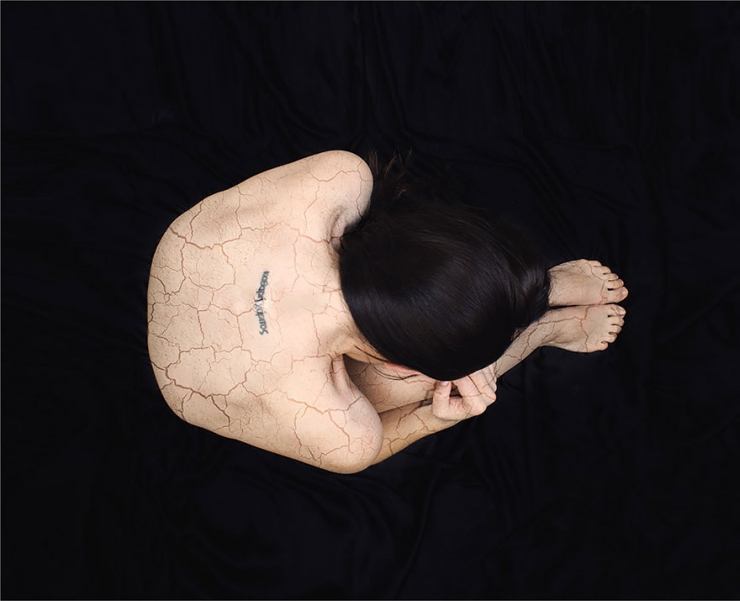 Illustration de l'article : Elle réalise des photos qui décrivent ce que lui provoque son anxiété... C’est prenant !