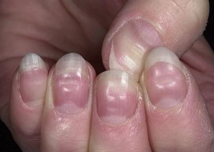 L'état de vos ongles en dit long sur votre santé et il peut être ...