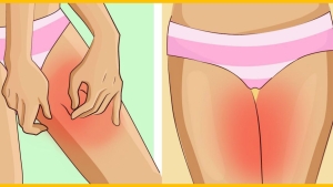 Illustration : "7 petits trucs pour éviter les irritations aux cuisses/jambes en été !"